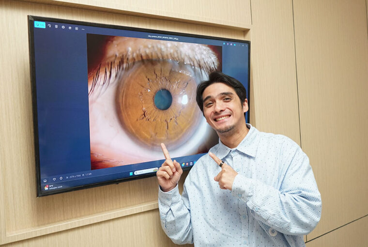 Ricky Harun Rela Lasik di NEC Surabaya